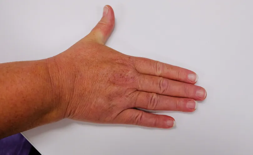 A hand with four fingers together and thumb splayed out.