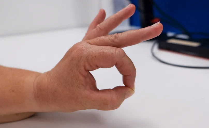 A hand doing the thumb opposition exercise by touching thumb tip to fingertip.